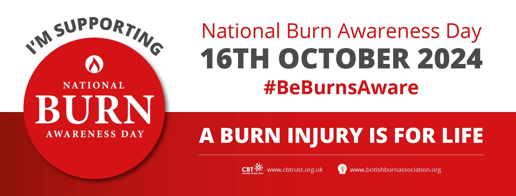 Article---Oct-2024-Burn-Awareness-Day